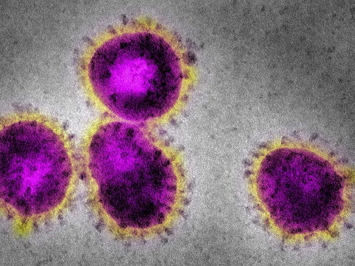 Draconian countermeasures have been adopted in many countries. If the pandemic dissipates — either on its own or because of these measures — short-term extreme social distancing and lockdowns may be bearable.