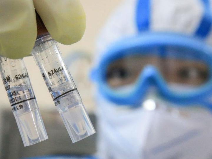 “I welcome the rapid response of IMI to the Coronavirus outbreak. This collaboration between the public and the private sectors brings their expertise and resources together in our fight against the Coronavirus outbreak."