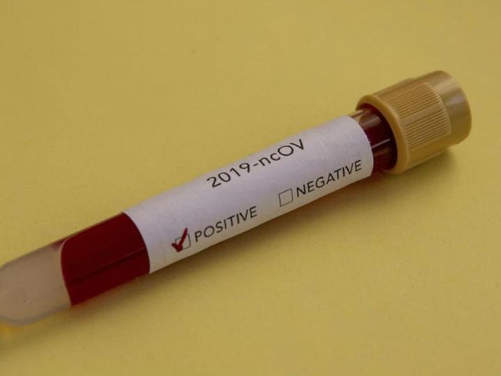 EU-countries have speedy access to the first ever RescEU stockpile of medical equipment, such as ventilators and protective masks, under the Civil Protection Mechanism. 