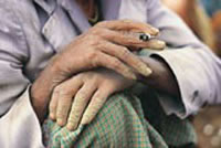 Health Commissioner backs tougher ban on smoking